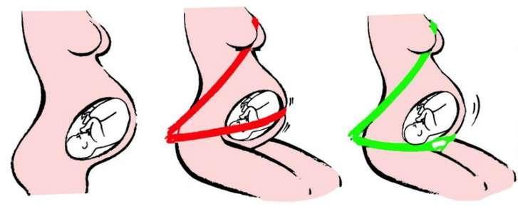 Bezpieczna, przyszła mama